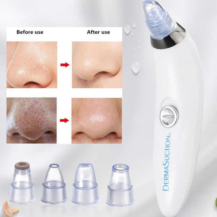 Pore and Skin Care Vacuum Tool