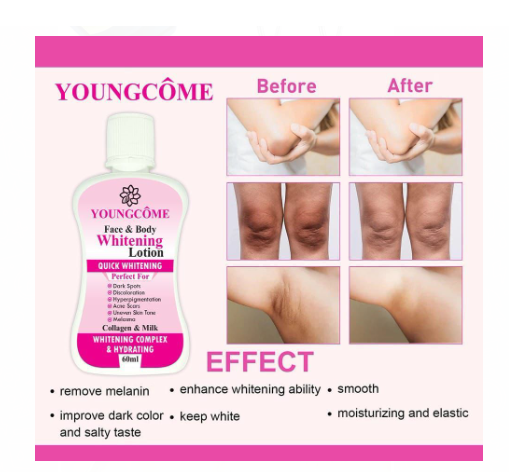 60ml Youngcome Face Body Whitening Lotion