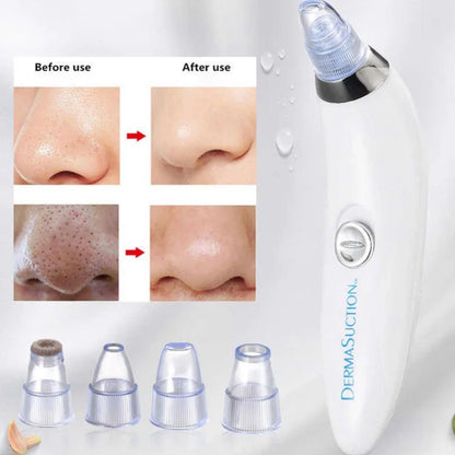 Pore and Skin Care Vacuum Tool